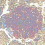 Ctph027