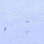 Ctph054